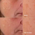 سرم ضد لک کلینیک مدل Even Better Clinical