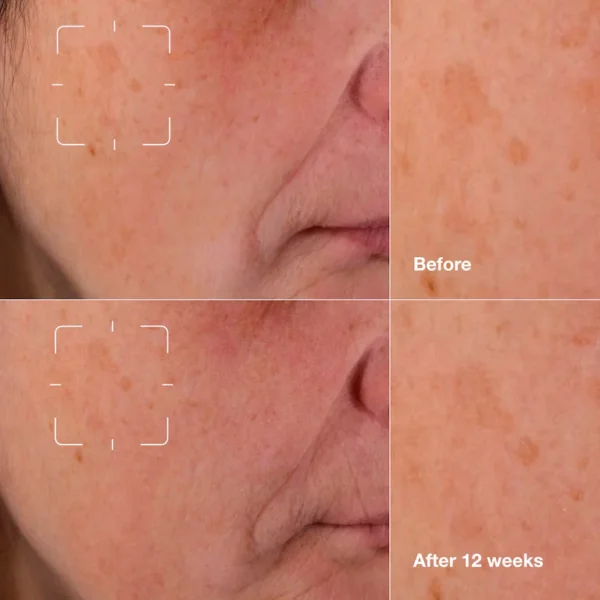 تصویر تست محصول سرم ضد لک کلینیک ایون بیتر کلینیکال Clinique Even Better Clinical™ Dark Spot Clearing Serum