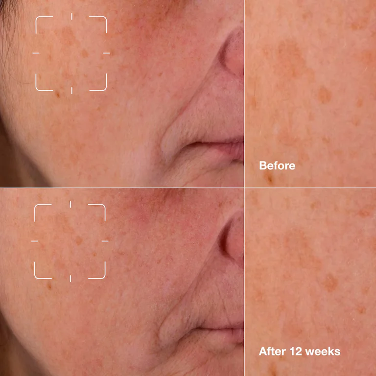 سرم ضد لک کلینیک مدل Even Better Clinical