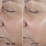 سرم ضد چروک کلینیک مدل Smart Clinical Repair