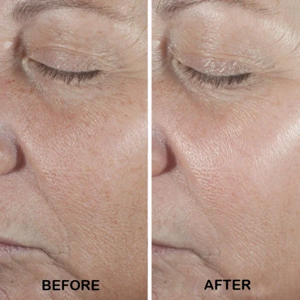 تصویر تست محصول سرم ضد چروک قوی کلینیک اسمارت Clinique Smart Clinical Repair™ Wrinkle Correcting Serum