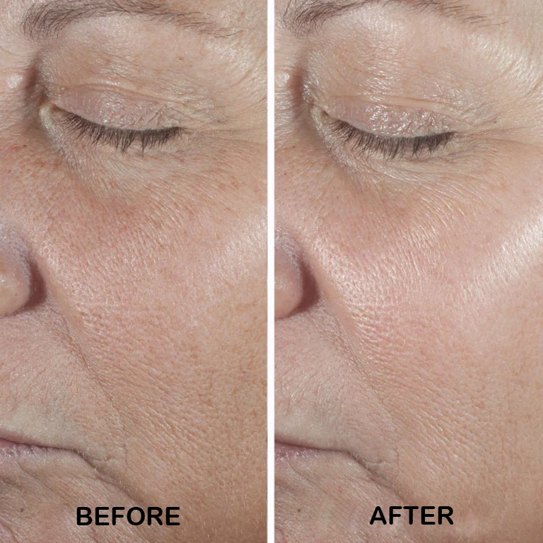 سرم ضد چروک کلینیک مدل Smart Clinical Repair