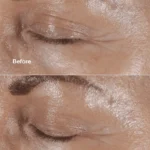 کرم دور چشم ضد چروک کلینیک مدل Smart Clinical Repair