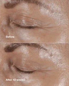 تصویر تست محصول کرم دور چشم ضد چروک کلینیک اسمارت کلینیکال ریپر Clinique Smart Clinical Repair™ Wrinkle Correcting Eye Cream