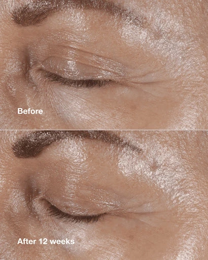 کرم دور چشم ضد چروک کلینیک مدل Smart Clinical Repair